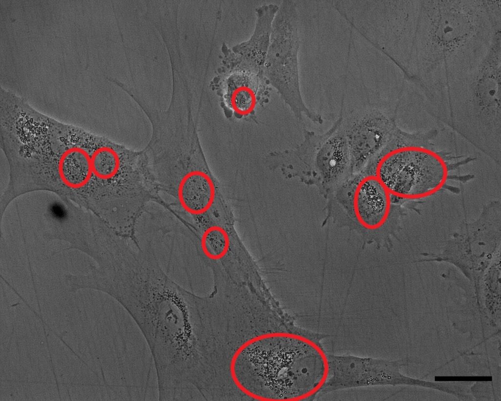 A grayscale phase-contrast microscopic image of several irregularly shaped biological cells adhered to a flat surface. Eight specific areas within the cells, containing dense clusters of small, dark granular structures or organelles, are highlighted with red circles of varying sizes. A solid black scale bar is visible in the bottom-right corner.