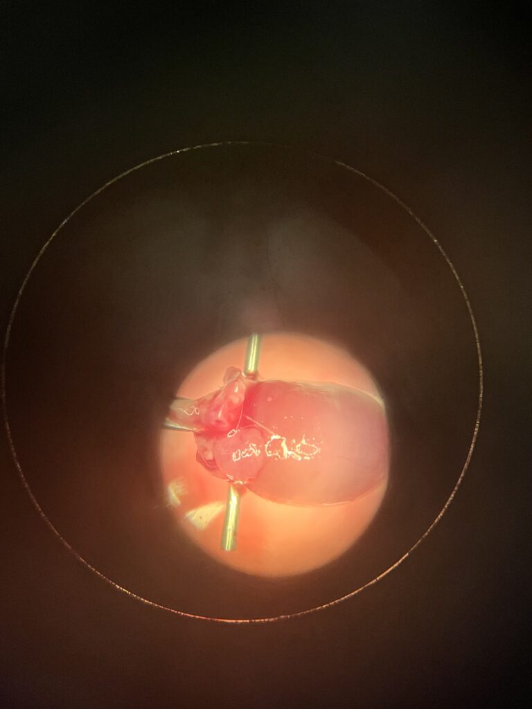A photograph taken through a circular lens or microscope eyepiece, showing a small, fleshy red biological specimen—possibly a tiny heart or organ—secured in place by two thin metal pins. The specimen is brightly illuminated in the center of the dark circular field, revealing a glistening, moist surface.