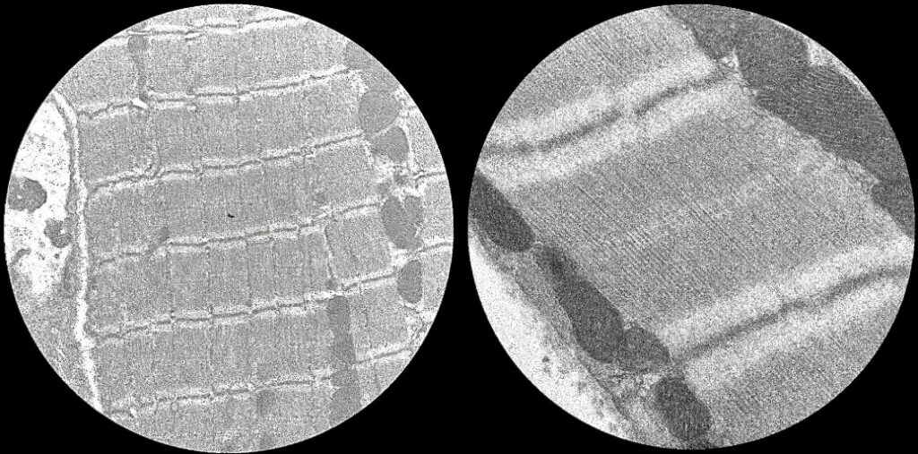 A black and white two-panel composite showing high-magnification electron microscopy views of muscle tissue. The left panel shows a broad grid-like pattern of striated muscle fibers (sarcomeres) within a circular frame. The right panel provides an even closer view in a second circular frame, revealing the fine, parallel longitudinal filaments that make up the individual contractile units, along with darker, rounded mitochondria along the edges.
