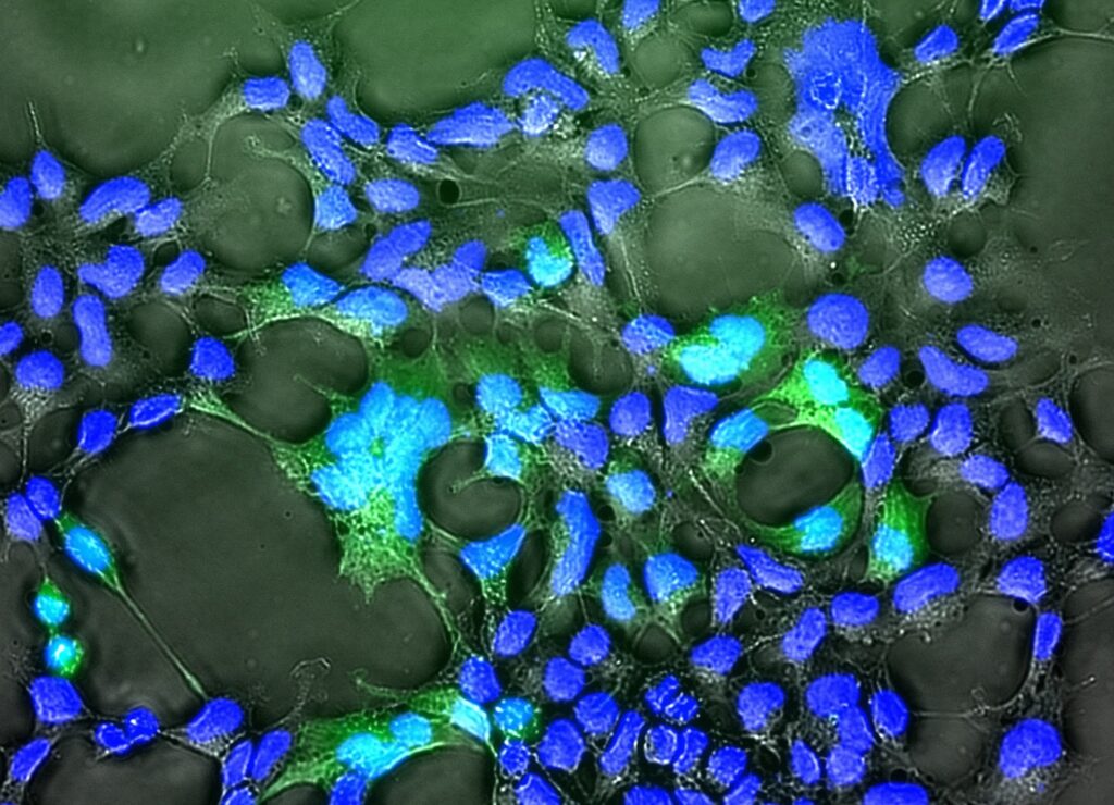 A fluorescence microscopy image showing a cluster of cells. Dozens of small, bright blue oval structures represent the cell nuclei, scattered across a dark, web-like background. Several cells also glow with a bright neon green. The cells appear interconnected by thin, faint filaments, creating a complex biological network.