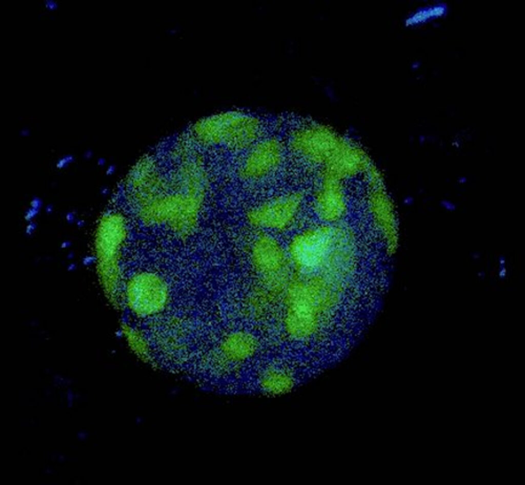 A grainy, high-contrast fluorescence microscopy image of a pancreatic islet of Langerhans. A redox-sensitive biosensor shows up as bright green clusters, highlighting the beta cells against a dark blue and black background. 
