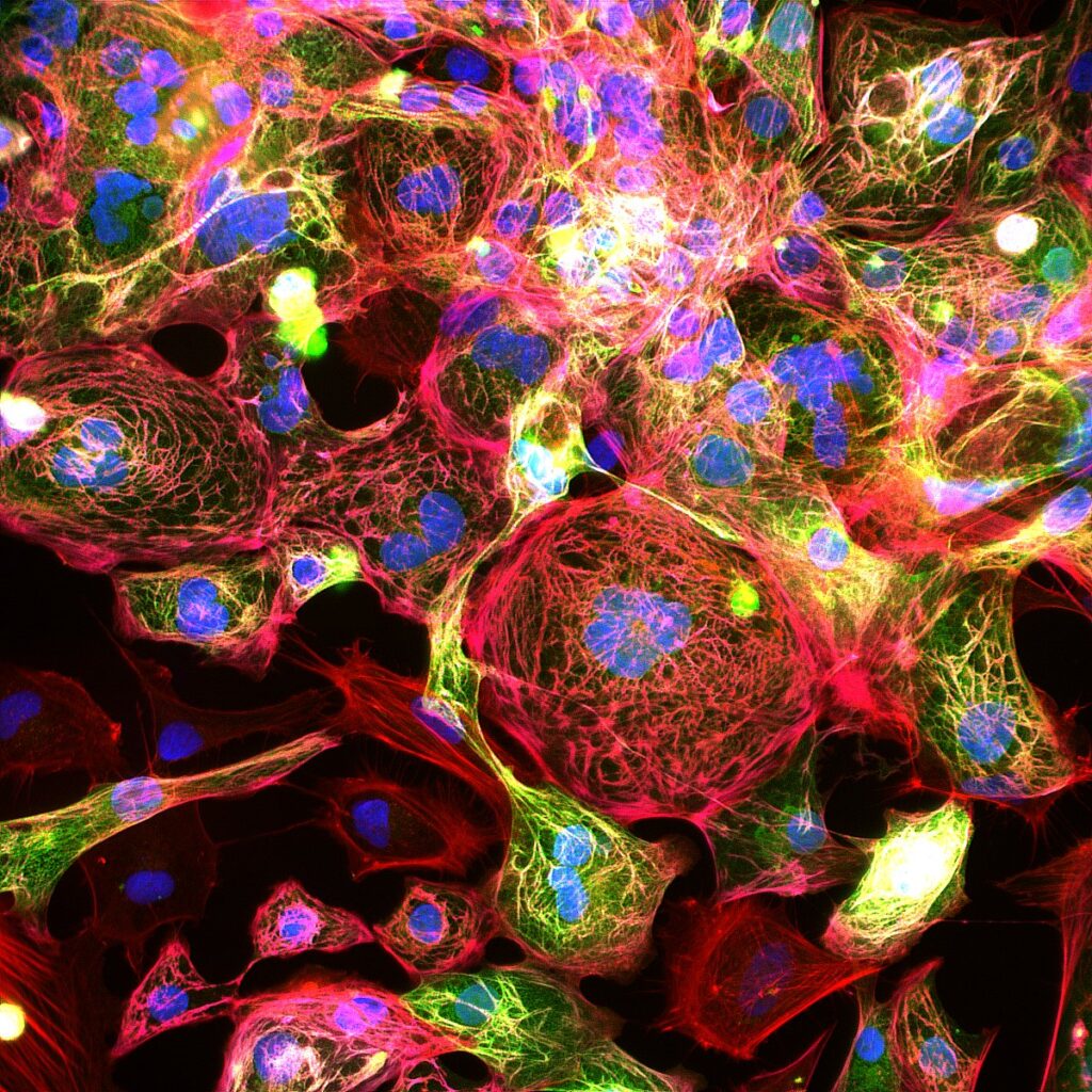 A dense fluorescence microscopy image showing a network of cells against a black background. The nuclei are stained a bright blue and are scattered throughout the frame. The cellular cytoplasm and cytoskeleton are represented by an intricate, overlapping web of vibrant magenta-red and neon-green filaments. 