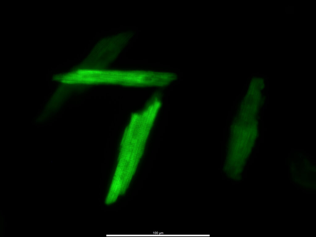 A fluorescence microscopy image featuring several isolated muscle cells (cardiomyocytes) glowing in a vibrant green against a black background. The cells are elongated with jagged ends, and a fine, striated pattern of internal structures is visible within the most brightly lit cell in the center. A $100\ \mu\text{m}$ scale bar is located at the bottom of the frame.
