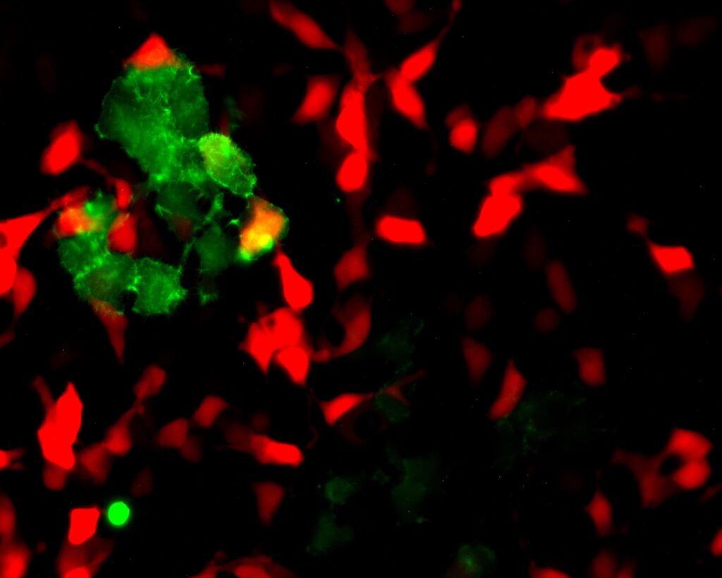 A fluorescence microscopy image of a cell population against a dark background. The majority of the cells are labeled with a bright red fluorescent marker, appearing as scattered, irregular shapes. A small cluster of cells in the upper-left quadrant is distinctly labeled in neon green, with a single bright green dot visible in the lower-left. The image shows the spatial distribution and overlap of these two differently labeled cell types