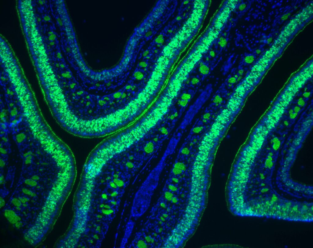A high-contrast microscopic image featuring undulating, ribbon-like organic structures against a black background. The structures are outlined in a vibrant, glowing neon green and contain numerous bright green circular spots, while the inner sections of the folds are filled with a deep electric blue speckled texture.