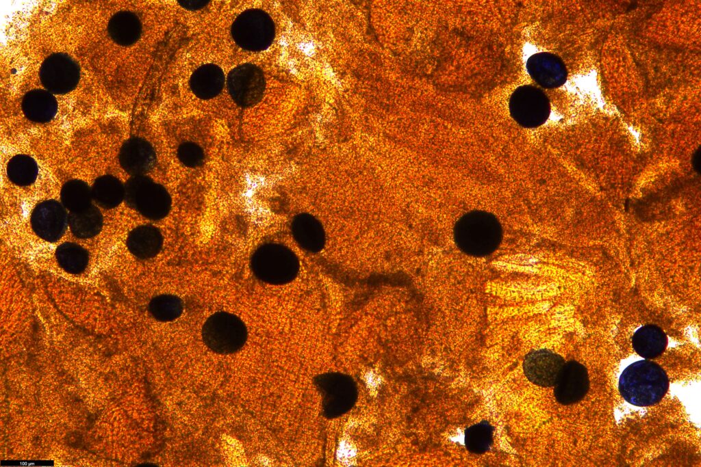 A high-magnification microscopic image featuring a dense, textured orange-gold organic field. Scattered throughout the frame are numerous dark, opaque circular spots of varying sizes, resembling small black and deep blue spheres or spores.