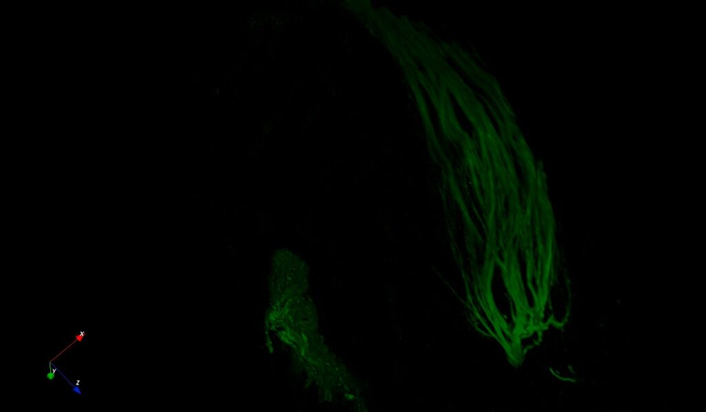 A microscopic or 3D rendered image against a black background. Bright green, fibrous, or thread-like structures cluster together in an elongated, vertical shape. A small XYZ axis coordinate indicator is visible in the bottom-left corner.