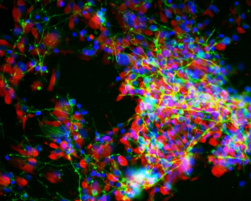 Brain Organoid in a Test Tube