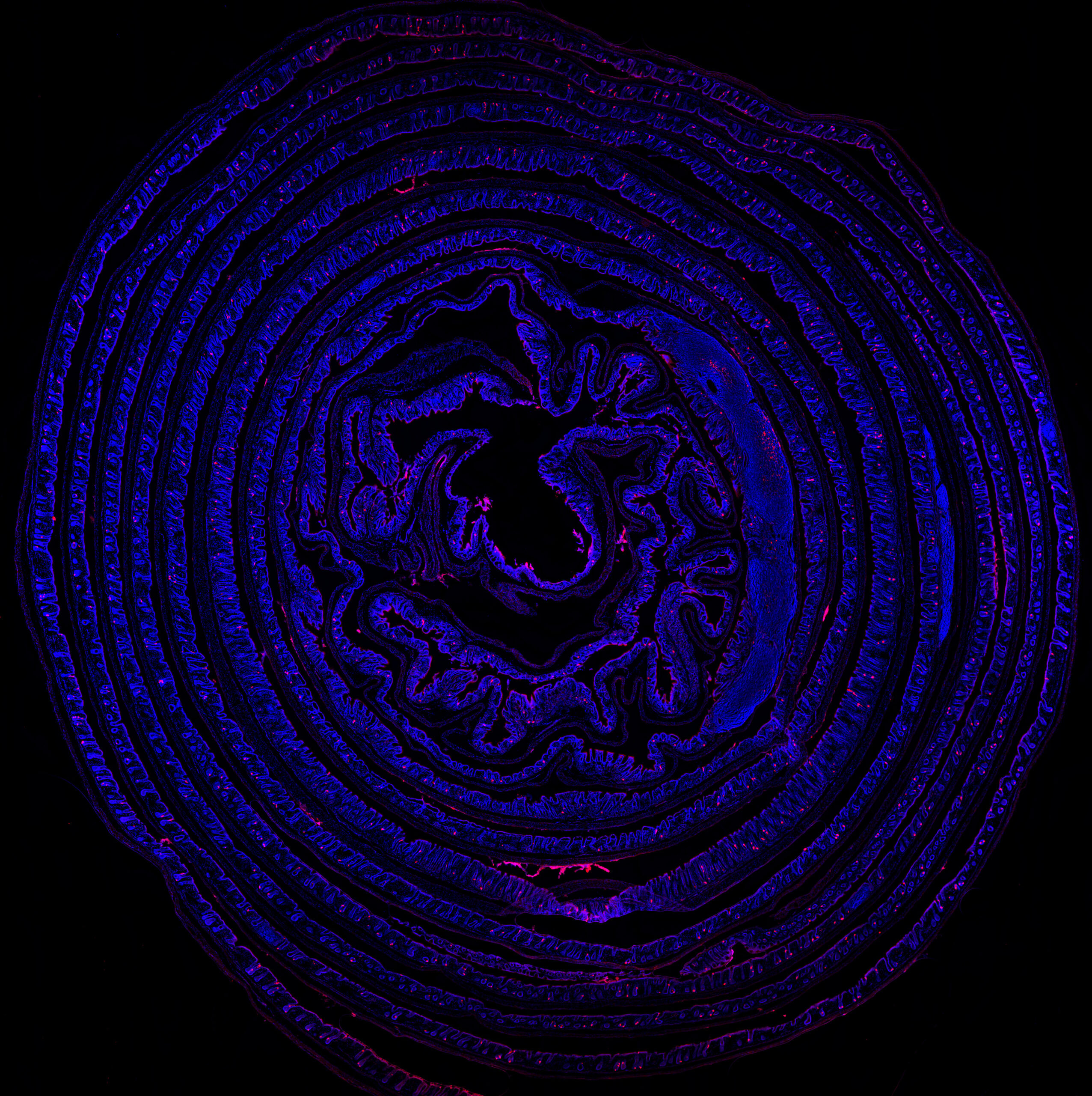 Unraveling the Second Brain
