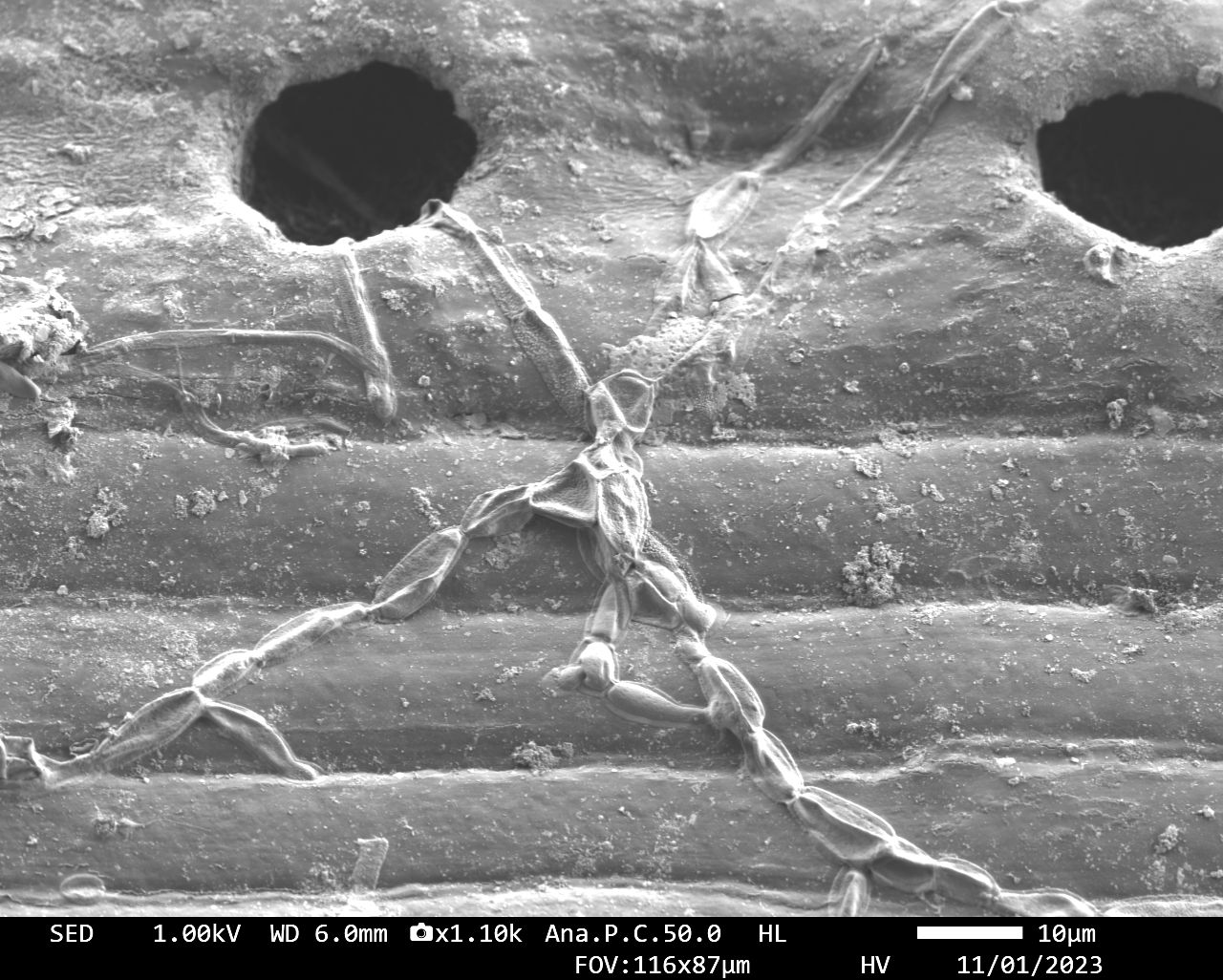 Microorganisms Investigating Stromata on Pine Needle