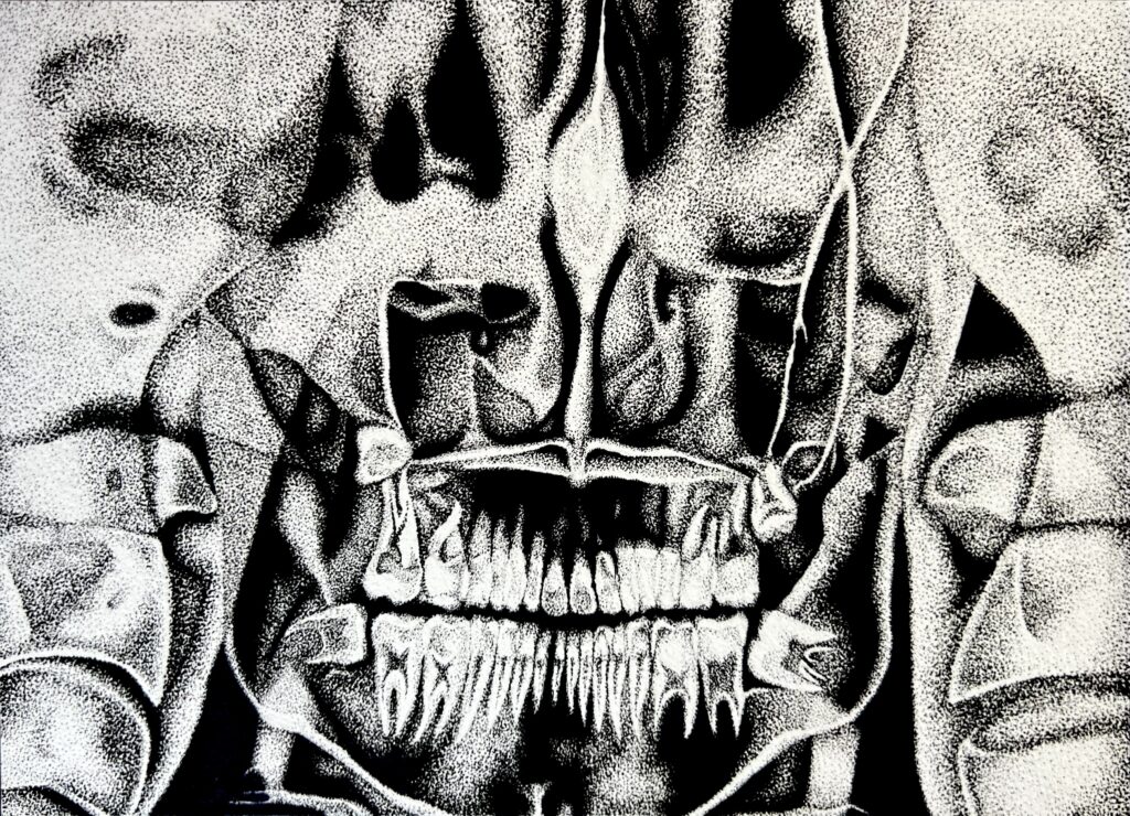 A photograph of a black-and-white stippled ink drawing. The artwork depicts a human dental X-ray, using dense pointillism to render the upper and lower teeth, roots, and facial bone structure. The image features high-contrast shadows and bright highlights, capturing the intricate, hand-dotted texture of the original piece against a stark background