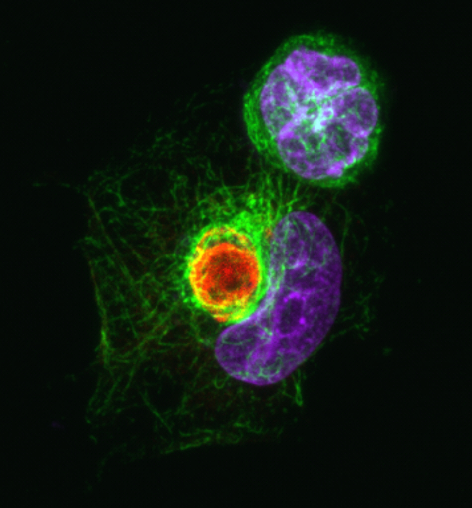 Zika Virus NS3 Drives the Assembly of the Viroplasm-Like Structure