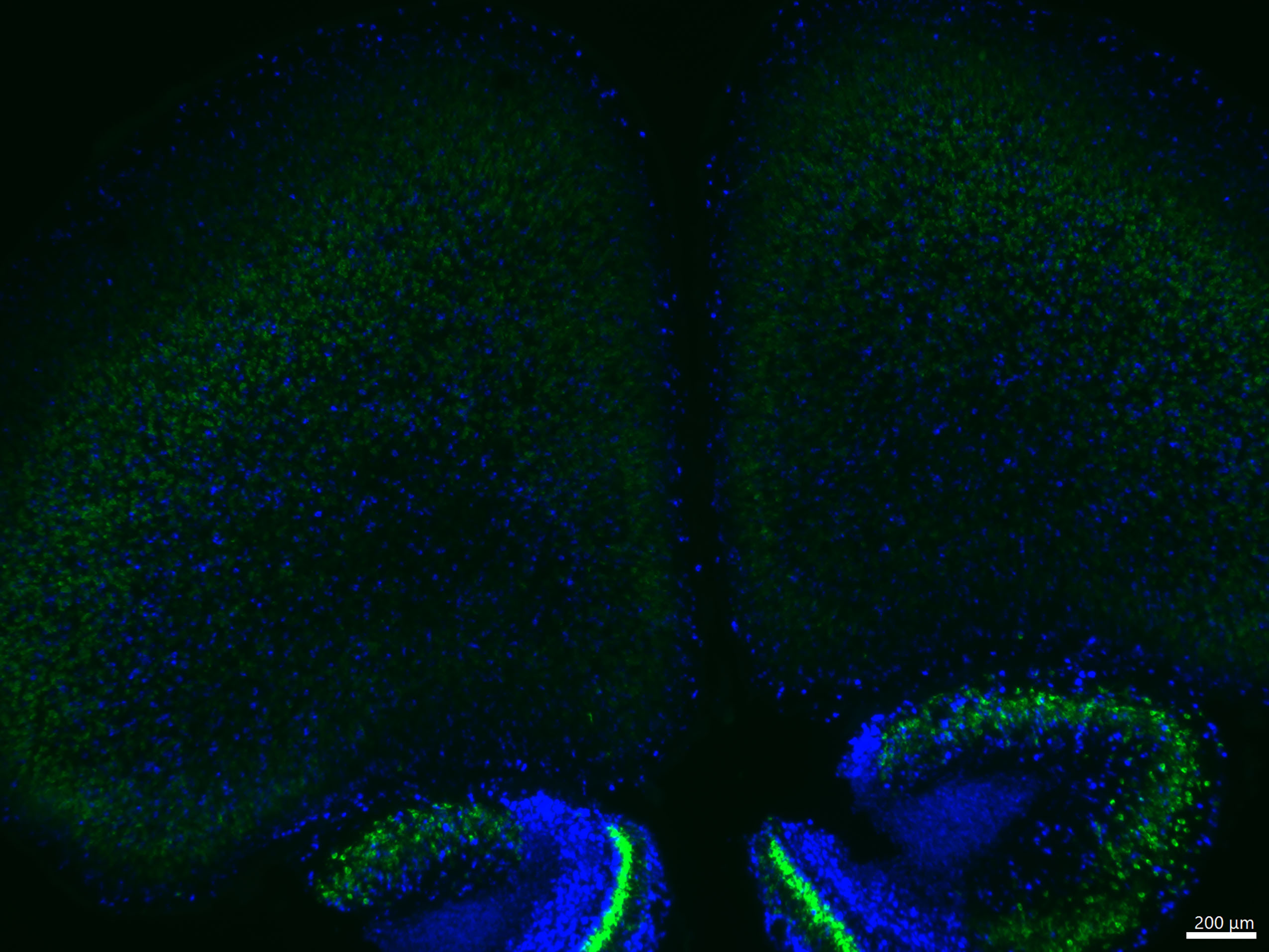 Excitatory and Inhibitory Neurons in the Developing Mouse Brain