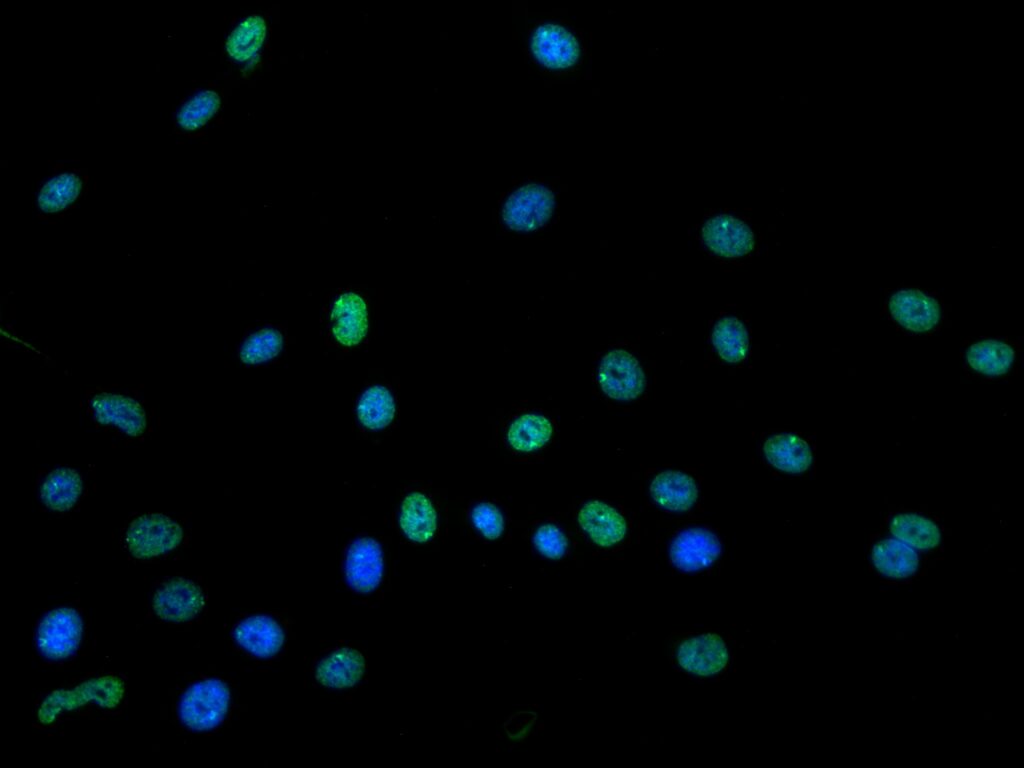 Microscope image of PX458 transfection.