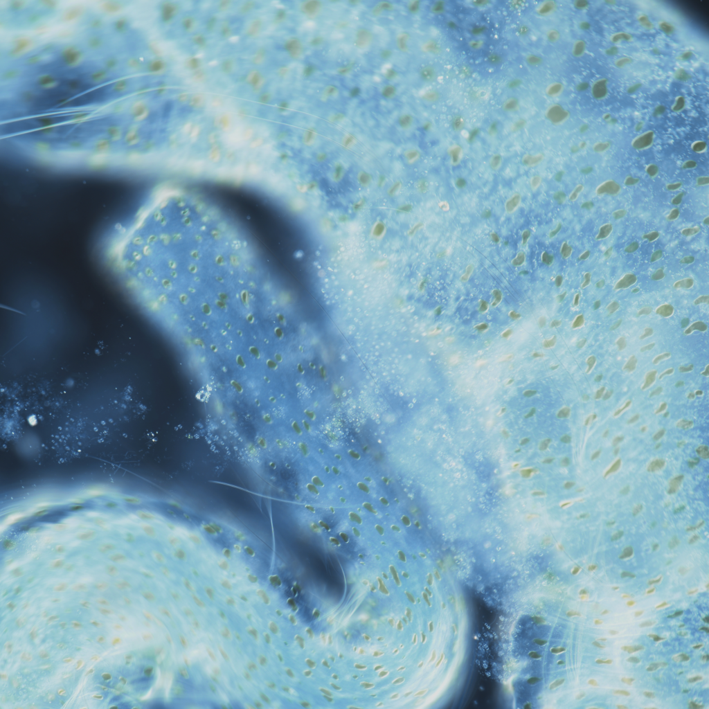 Two aeolosoma moving against one another, microscope image.