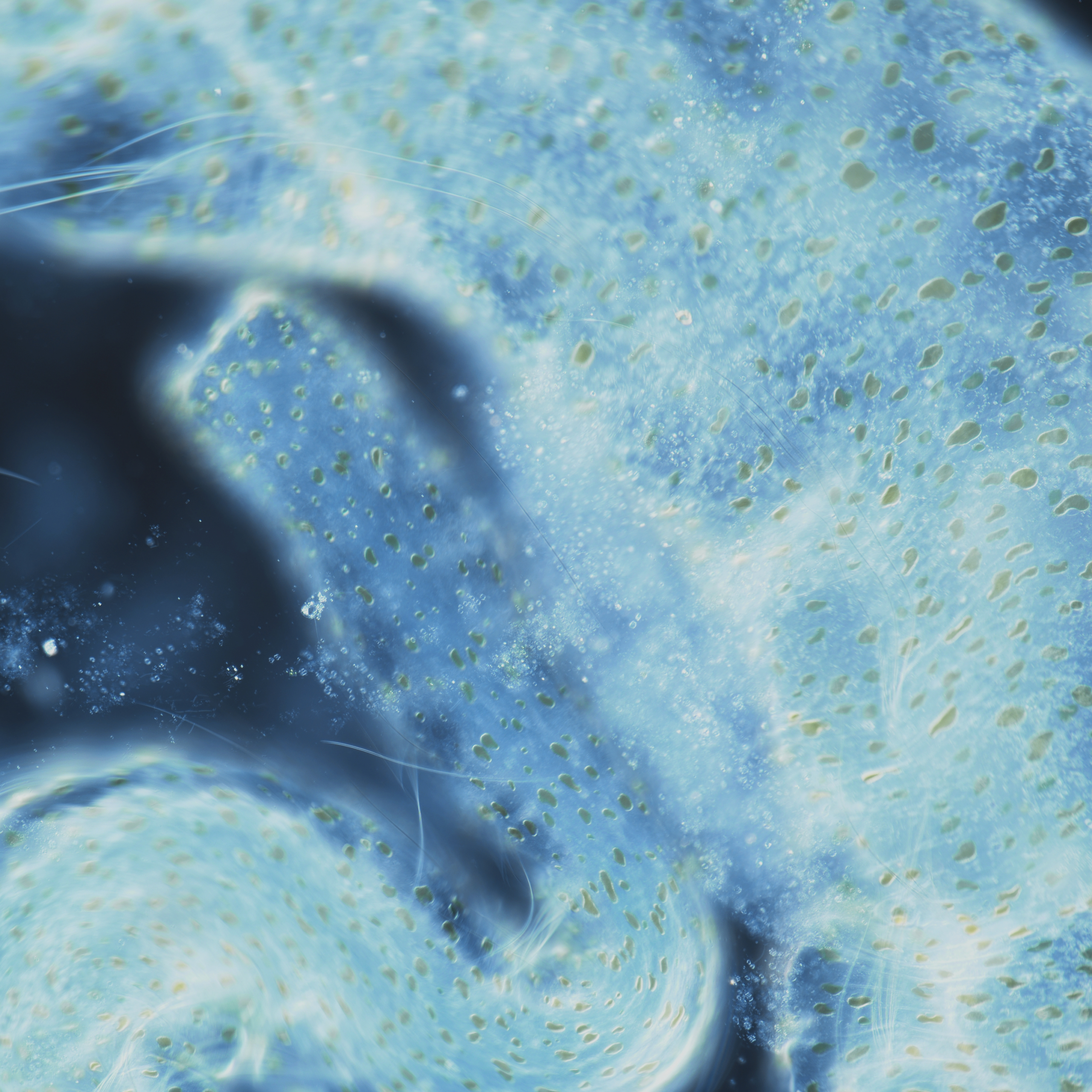 Two Aeolosoma in Motion
