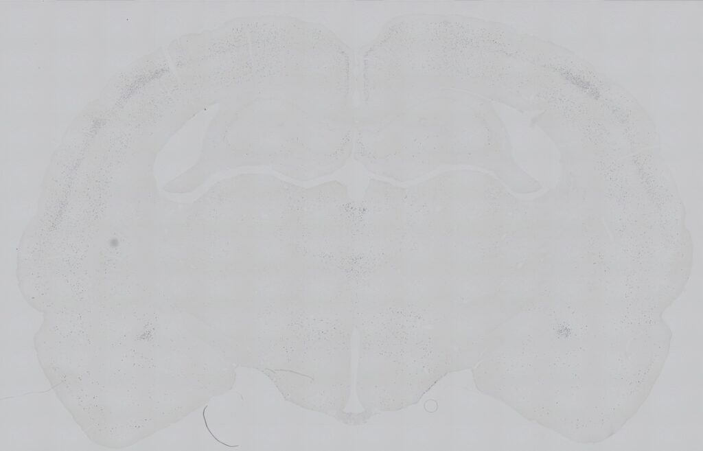 Section of a rat brain under the microscope.