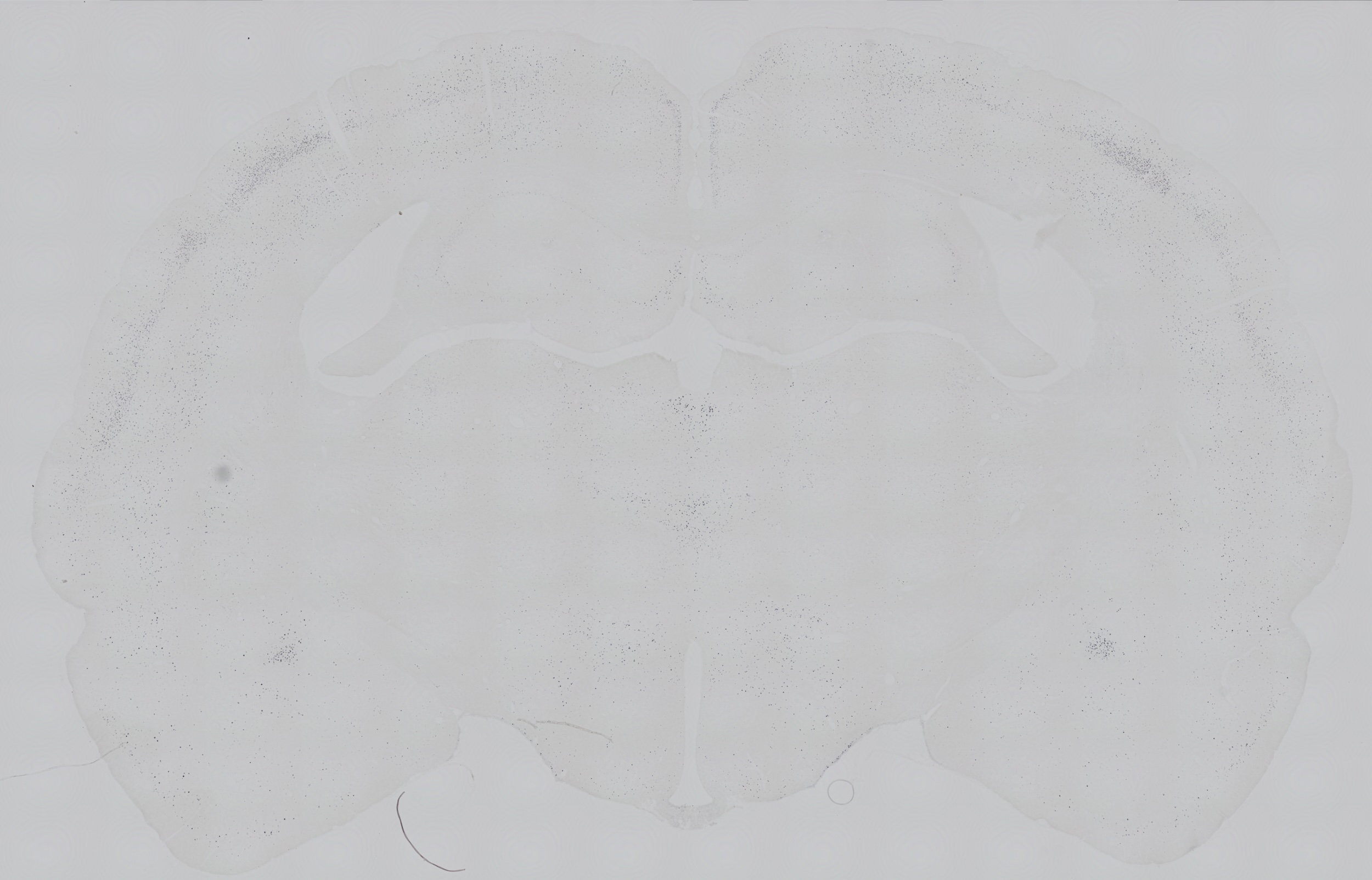 Neuronal activation of GLP-1 receptor agonist