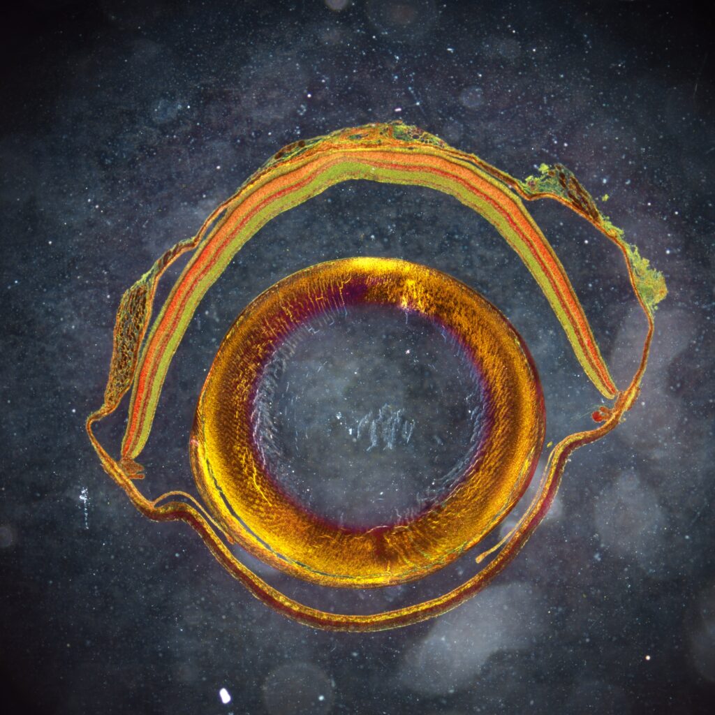 Mammal eye under a microscope.